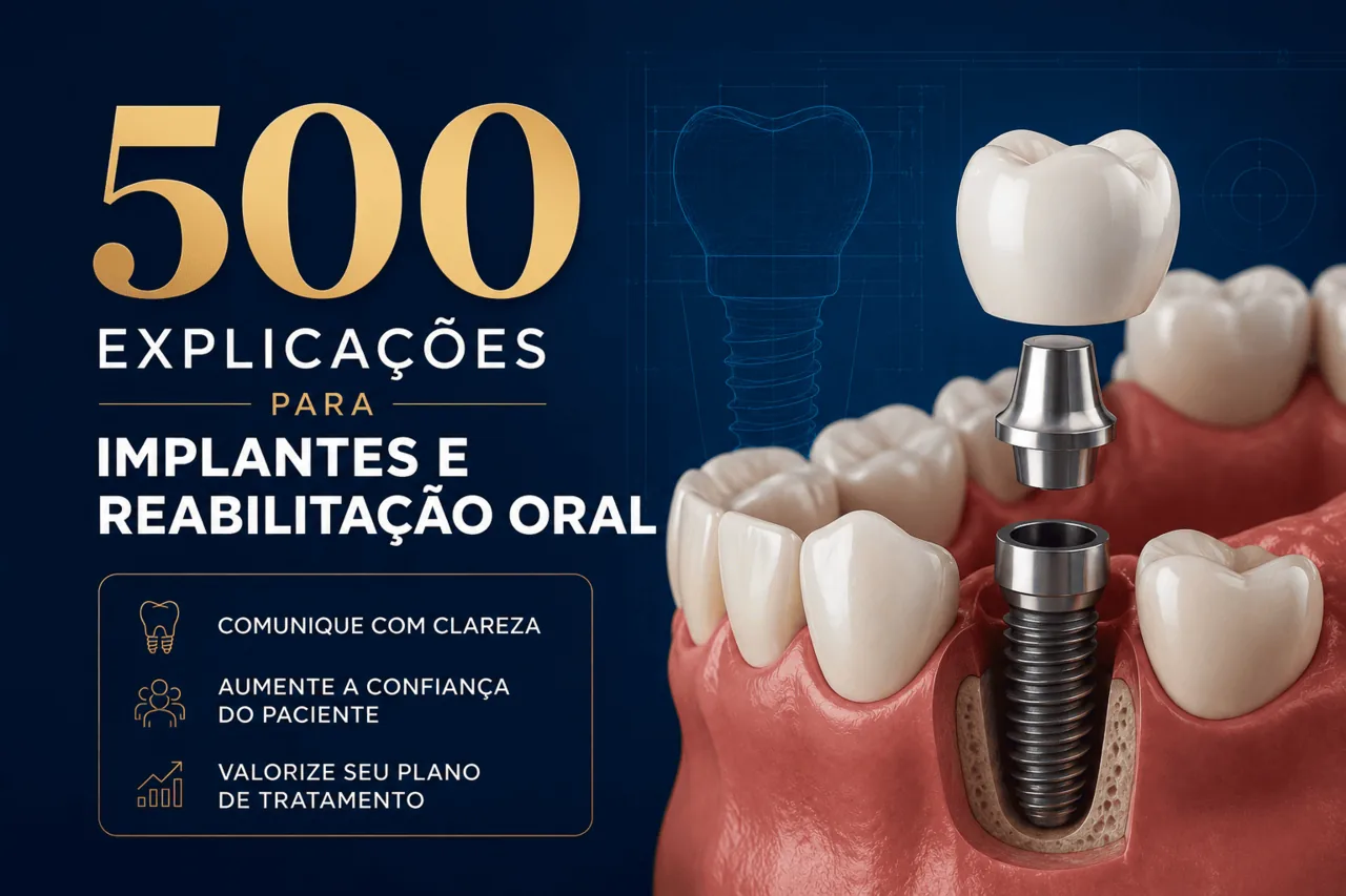 500 Explicações para Implantes e Reabilitação Oral